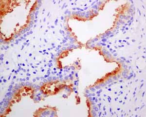 Immunohistochemistry (Formalin/PFA-fixed paraffin-embedded sections) - Anti-PSMA antibody [EPR6253] (AB133579)