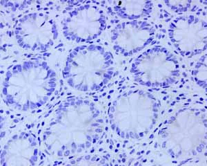 Immunohistochemistry (Formalin/PFA-fixed paraffin-embedded sections) - Anti-PSMA antibody [EPR6253] (AB133579)
