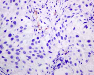 Immunohistochemistry (Formalin/PFA-fixed paraffin-embedded sections) - Anti-PSMA antibody [EPR6253] (ab133579), expandable thumbnail
