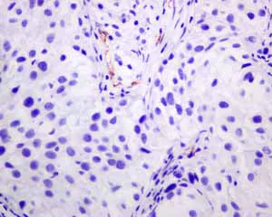 Immunohistochemistry (Formalin/PFA-fixed paraffin-embedded sections) - Anti-PSMA antibody [EPR6253] (AB133579)