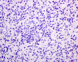 Immunohistochemistry (Formalin/PFA-fixed paraffin-embedded sections) - Anti-PSMA antibody [EPR6253] (ab133579), expandable thumbnail