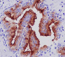 Immunohistochemistry (Formalin/PFA-fixed paraffin-embedded sections) - Anti-PSMA antibody [EPR6253] (AB133579), expandable thumbnail