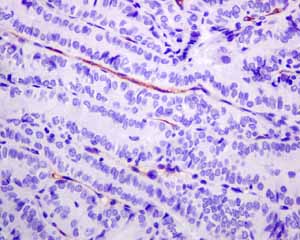 Immunohistochemistry (Formalin/PFA-fixed paraffin-embedded sections) - Anti-PSMA antibody [EPR6253] (ab133579), expandable thumbnail