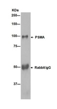 Immunoprecipitation - Anti-PSMA antibody [EPR6253] (AB133579), expandable thumbnail