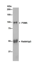 Immunoprecipitation - Anti-PSMA antibody [EPR6253] (AB133579)