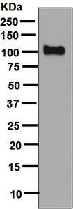 Western blot - Anti-PSMA antibody [EPR6253] (AB133579), expandable thumbnail