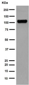 Western blot - Anti-PSMA antibody [EPR6253] (AB133579), expandable thumbnail