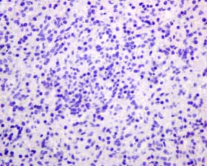 Immunohistochemistry (Formalin/PFA-fixed paraffin-embedded sections) - Anti-PSMA antibody [EPR6253] - BSA and Azide free (AB226141)