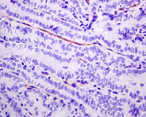 Immunohistochemistry (Formalin/PFA-fixed paraffin-embedded sections) - Anti-PSMA antibody [EPR6253] - BSA and Azide free (AB226141)