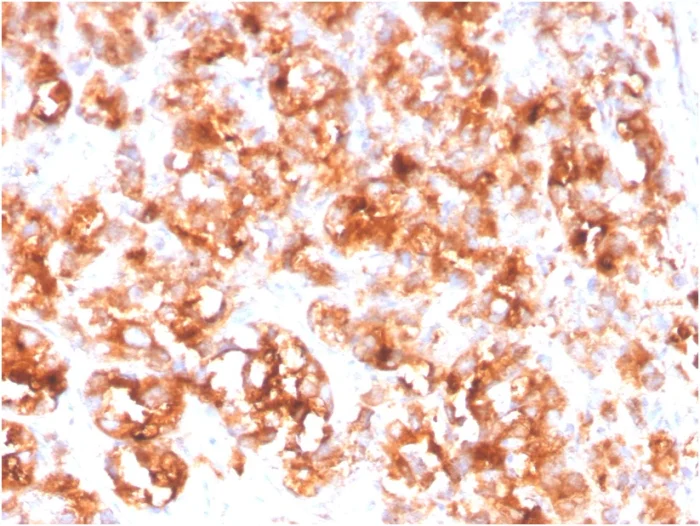 Immunohistochemistry (Formalin/PFA-fixed paraffin-embedded sections) - Anti-PSMA antibody [FOLH1/3734] - BSA and Azide free (AB268182)
