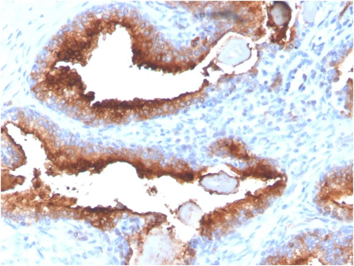 Immunohistochemistry (Formalin/PFA-fixed paraffin-embedded sections) - Anti-PSMA antibody [FOLH1/3734] - BSA and Azide free (AB268182)