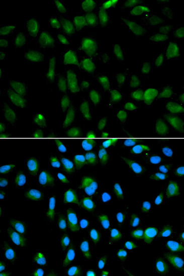 Immunocytochemistry/ Immunofluorescence - Anti-PSMA3 antibody (AB180784)