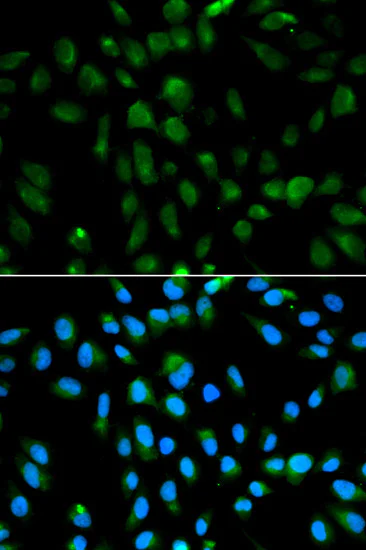 Immunocytochemistry/ Immunofluorescence - Anti-PSMA3 antibody (AB180784)