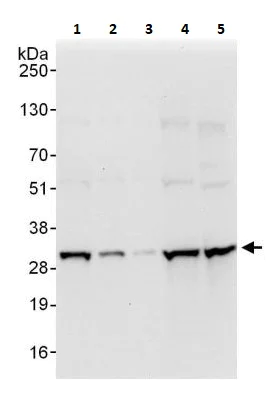 Western blot - Anti-PSMA3 antibody (AB264307)