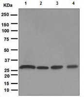 Western blot - Anti-PSMA3 antibody [EPR5455] (AB109532)