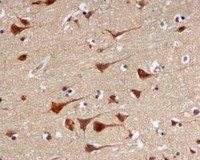 Immunohistochemistry (Formalin/PFA-fixed paraffin-embedded sections) - Anti-PSMA3 antibody [EPR5455] - BSA and Azide free (AB247895)
