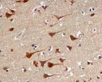 Immunohistochemistry (Formalin/PFA-fixed paraffin-embedded sections) - Anti-PSMA3 antibody [EPR5455] - BSA and Azide free (AB247895)
