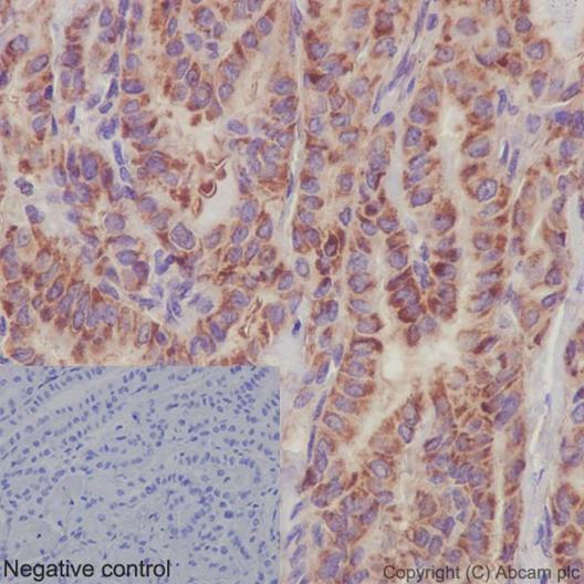 Immunohistochemistry (Formalin/PFA-fixed paraffin-embedded sections) - Anti-PSMA4 antibody [EPR5831(2)] (AB191403)