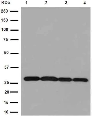 Western blot - Anti-PSMA4 antibody [EPR5831(2)] (AB191403)