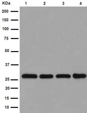 Western blot - Anti-PSMA4 antibody [EPR5831(2)] (AB191403)