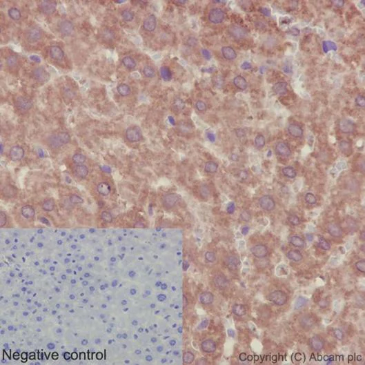 Immunohistochemistry (Formalin/PFA-fixed paraffin-embedded sections) - Anti-PSMA4 antibody [EPR5831(2)] - BSA and Azide free (AB236158)