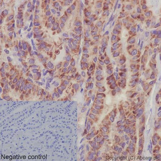 Immunohistochemistry (Formalin/PFA-fixed paraffin-embedded sections) - Anti-PSMA4 antibody [EPR5831(2)] - BSA and Azide free (AB236158)