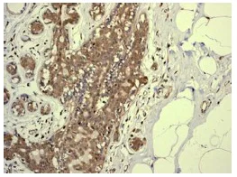 Immunohistochemistry (Formalin/PFA-fixed paraffin-embedded sections) - Anti-PSMA7/HSPC antibody [EPR5836] (AB133502)