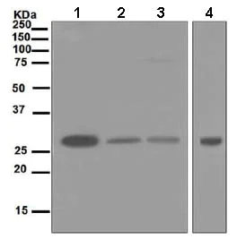 Western blot - Anti-PSMA7/HSPC antibody [EPR5836] (AB133502)