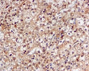 Immunohistochemistry (Formalin/PFA-fixed paraffin-embedded sections) - Anti-PSMA7/HSPC antibody [EPR5837] (AB109378)