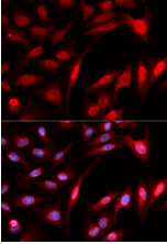 Immunocytochemistry/ Immunofluorescence - Anti-PSMB1 antibody (AB196623), expandable thumbnail