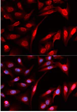 Immunocytochemistry/ Immunofluorescence - Anti-PSMB1 antibody (AB196623)