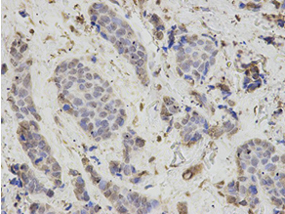 Immunohistochemistry (Formalin/PFA-fixed paraffin-embedded sections) - Anti-PSMB1 antibody (AB196623), expandable thumbnail