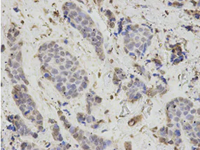 Immunohistochemistry (Formalin/PFA-fixed paraffin-embedded sections) - Anti-PSMB1 antibody (AB196623)