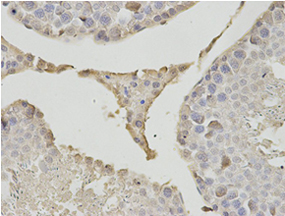 Immunohistochemistry (Formalin/PFA-fixed paraffin-embedded sections) - Anti-PSMB1 antibody (AB196623), expandable thumbnail