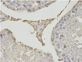Immunohistochemistry (Formalin/PFA-fixed paraffin-embedded sections) - Anti-PSMB1 antibody (AB196623)
