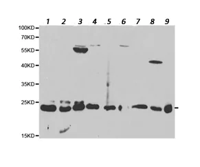 Western blot - Anti-PSMB1 antibody (AB196623)