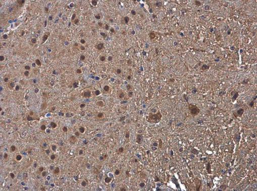 Immunohistochemistry (Formalin/PFA-fixed paraffin-embedded sections) - Anti-PSMB1 antibody (AB229491)