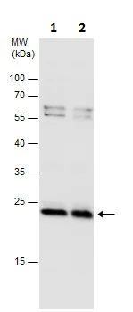 Western blot - Anti-PSMB1 antibody (AB229491)