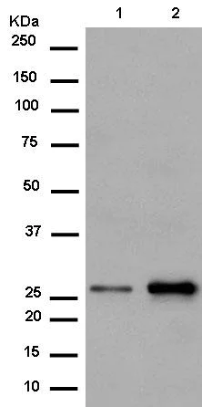 Western blot - Anti-PSMB10/MECL1 antibody [EPR14902] (AB183506)