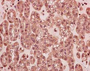 Immunohistochemistry (Formalin/PFA-fixed paraffin-embedded sections) - Anti-PSMB10/MECL1 antibody [EPR14902] - BSA and Azide free (AB240272)