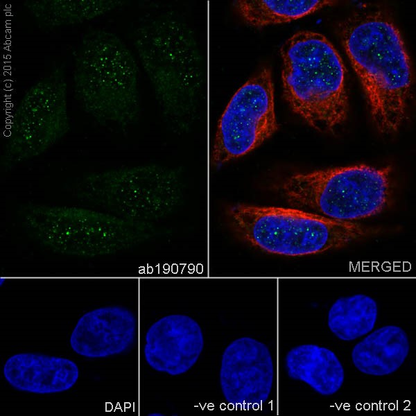 Immunocytochemistry/ Immunofluorescence - Anti-PSMB10/MECL1 antibody [EPR14903] (AB190790), expandable thumbnail