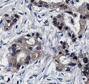 Immunohistochemistry (Formalin/PFA-fixed paraffin-embedded sections) - Anti-PSMB10/MECL1 antibody [SR4262] (AB326704)