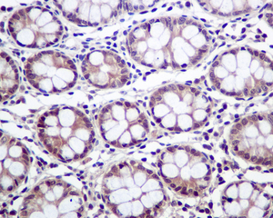 Immunohistochemistry (Formalin/PFA-fixed paraffin-embedded sections) - Anti-PSMB4 antibody [EPR9396] - BSA and Azide free (AB248796)