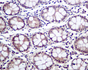 Immunohistochemistry (Formalin/PFA-fixed paraffin-embedded sections) - Anti-PSMB4 antibody [EPR9396] - BSA and Azide free (AB248796)