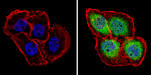 Anti-PSMB5/MB1 antibody
