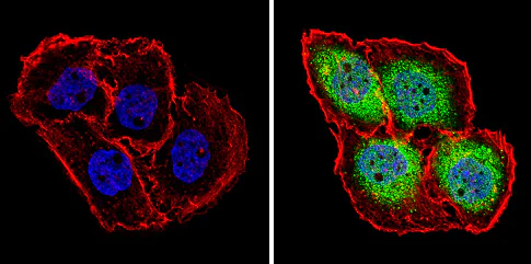 Immunocytochemistry - Anti-PSMB5/MB1 antibody (AB3330)