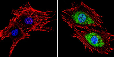 Immunocytochemistry - Anti-PSMB5/MB1 antibody (AB3330)