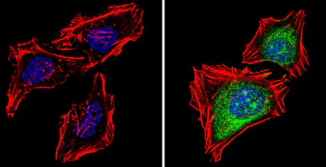 Immunocytochemistry - Anti-PSMB5/MB1 antibody (AB3330)