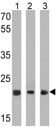 Western blot - Anti-PSMB5/MB1 antibody (AB3330)
