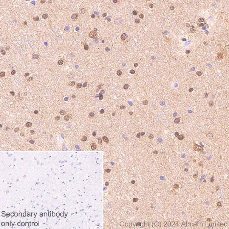 Immunohistochemistry (Formalin/PFA-fixed paraffin-embedded sections) - Anti-PSMB5/MB1 antibody [EPR28990-5] (AB321797)
